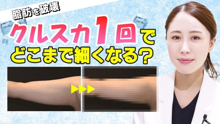 【 部分痩せ 】痩せにくい箇所におすすめ！ クルスカ の症例をご紹介【 医師解説 】